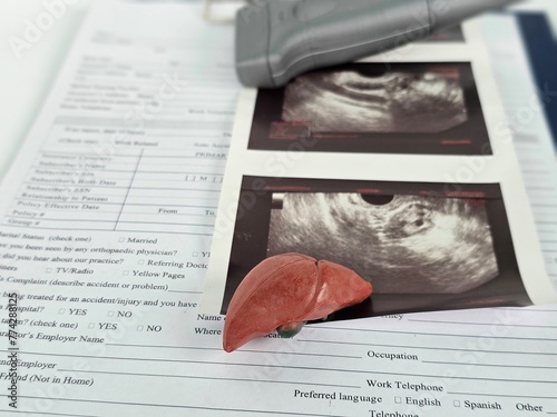 Ultrasound diagnosis of stomach and liver on abdominal cavity of in clinic photo