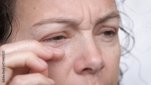 Allergy to the eyes. Close-up of an adult woman's face rubbing her puffy eyes. photo