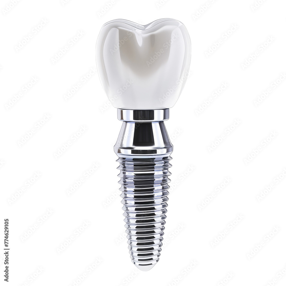 Dental implant detail isolated on transparent background Dental implant detail isolated on transparent background