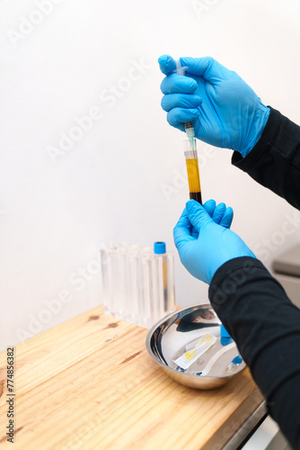 Gloved hands handle a blood sample for PRP preparation.