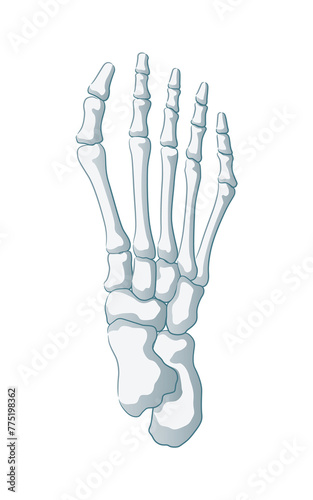 リウマチの足の骨