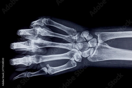Hand and wrist x-ray from radiology clinic