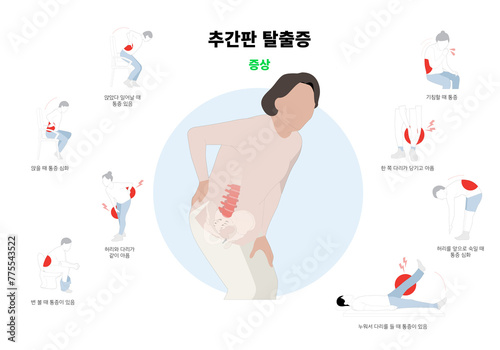 posture correction infographics