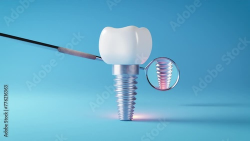 dental implant and dental inspection teeth