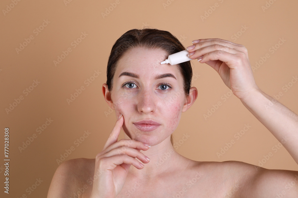 Young woman with acne problem applying cosmetic product onto her skin on beige background