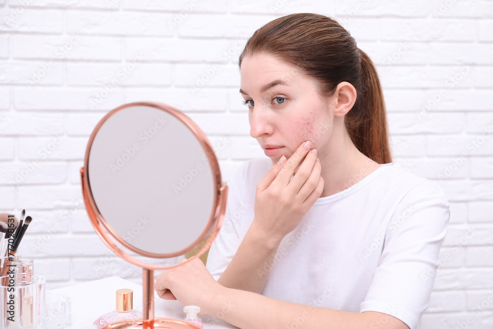 Woman with acne problem looking at mirror indoors Woman with acne problem looking at mirror indoors