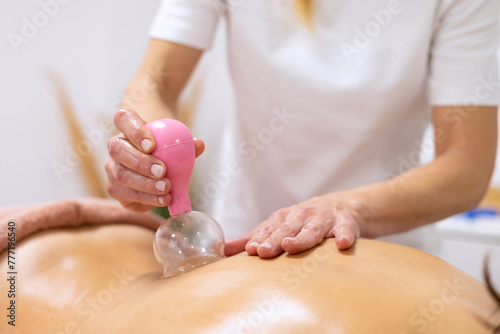 Masseuse doing a relaxing massage with cupping technique photo