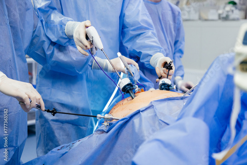 Doctor in blue sterile surgical gown doing surgery with camera and instrument. Keyhole surgery was perform in modern operating room. Advanced laparoscopy photo