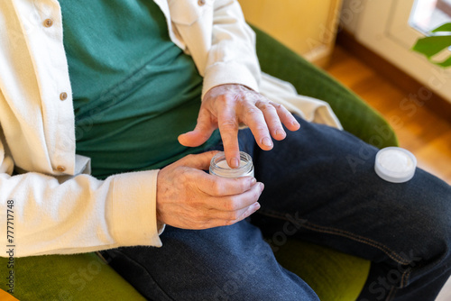 senior man vitiligo hand cream photo