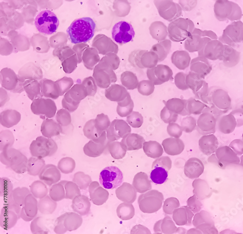 Obraz na plátně Bone marrow study (BMD)