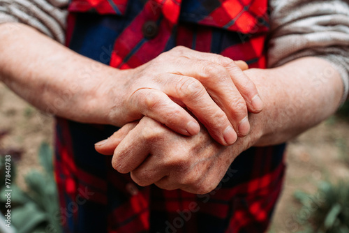 Elderly woman showing her hands joints