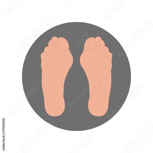 Foot deformation in human