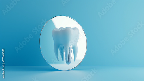 3D Dental Implant Representation with Mirror Reflection on Blue Background