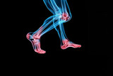 2 jambes vues en radiologie, à la façon d'un scanner, avec certaines articulations en rouge, pour indiquer une pathologie, les autres os en bleu. Des pieds à mi-cuisse, sur fond noir avec copy space
