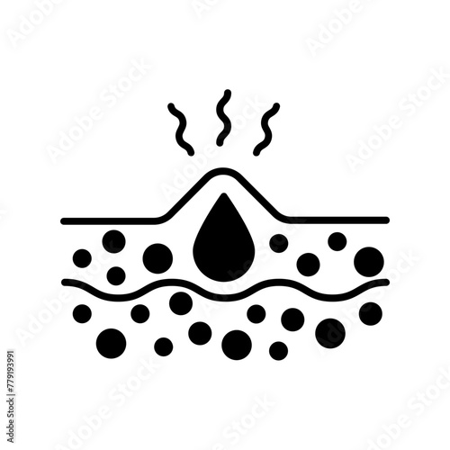 acne icon. black fill icon