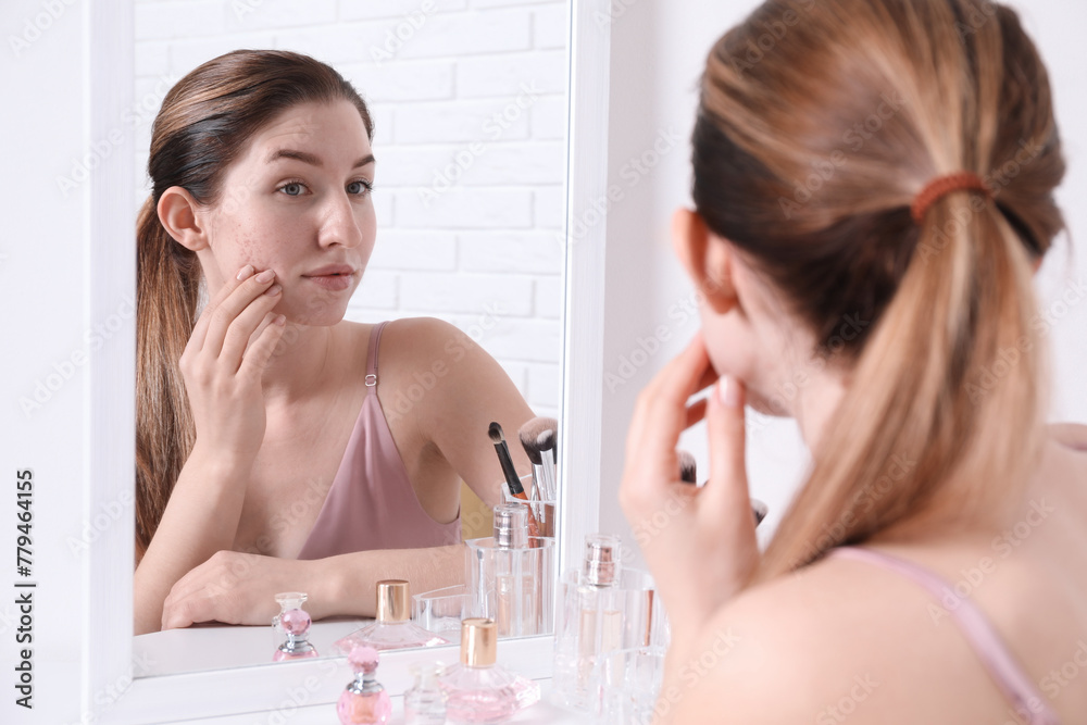 Woman with acne problem near mirror indoors Woman with acne problem near mirror indoors