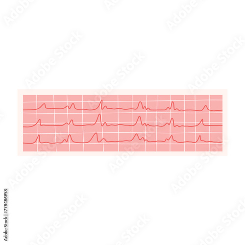 ECG vector illustration. Electrocardiogram isolated on a white background.