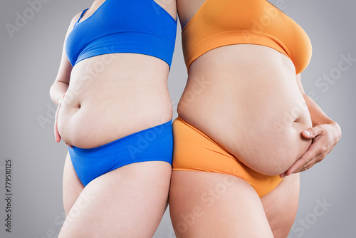 Tummy tuck, two fat women with cellulitis and flabby bellies on gray background, obese female body, plastic surgery and liposuction concept