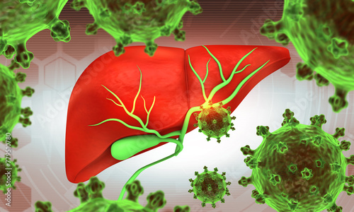 Human liver with .hepatitis  virus. infection. 3d illustration..