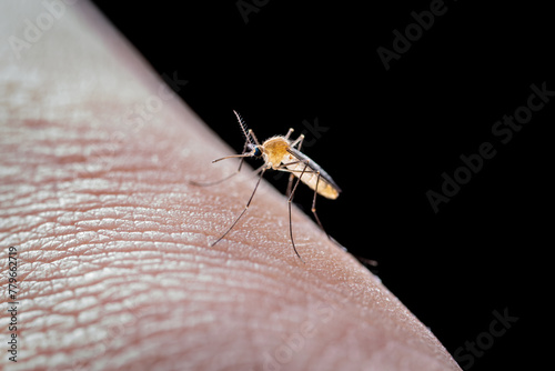 Dangerous Zika Infected Mosquito Skin Bite. Leishmaniasis, Encephalitis, Yellow Fever, Dengue, Malaria Disease, Mayaro or Zika Virus Infectious Culex Mosquito Parasite Insect Macro.
