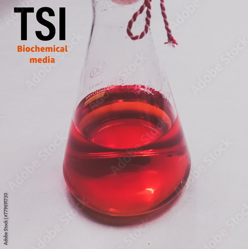 Biochemical test in microbiological liquid media. Blood agar plate, medical background. Microbiological examination. Culture and sensitivity testing. Triple sugar iron agar(TSI). photo