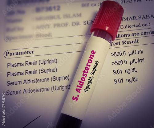 Blood sample for Aldosterone hormone test with report. photo