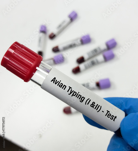 Blood Sample for Avian typing I and II test, avian influenza virus (AIV), avian flu or bird flu.