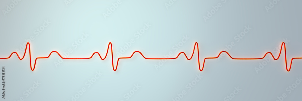 ECG of bundle branch block, 3D illustration