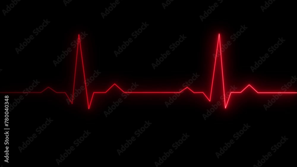 Vidéo Stock ECG cardiogram oscilloscope. Heartbeat line showing.Heart