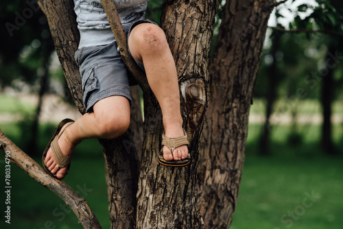 Close up of child's dirty legs climbing tree in summer photo