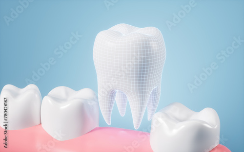 Fototapeta Naklejka Na Ścianę i Meble -  Human tooth model, tooth implantation, orthodontics, 3d rendering.