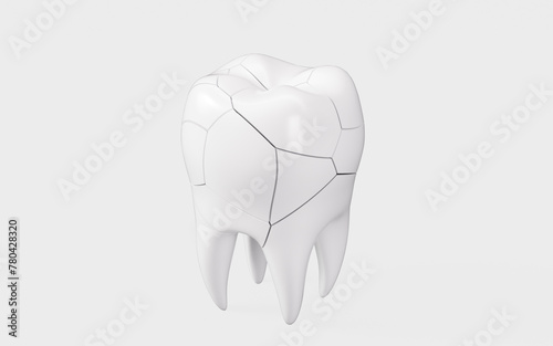 Human tooth model, tooth cracking, oral rehabilitation, 3d rendering.