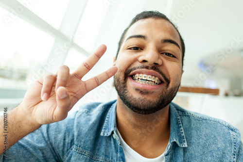cherful African American man with braces smiles and shows peace gesture in white room, man with stubble shows two fingers and greets photo