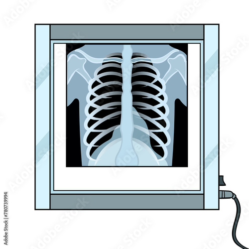 Xray chest in negatoscope pop art PNG photo