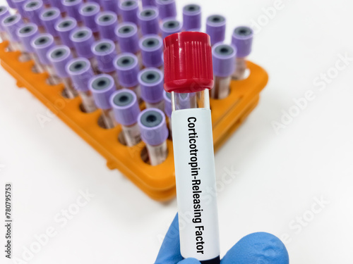 Corticotropin-releasing factor (CRF) test, also called Corticotropin-releasing hormone (CRH), is a peptide hormone that activates the synthesis and release of adrenocorticotropic hormone (ACTH). photo