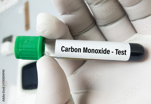 Blood sample for carbon monoxide test which is used to diagnose carbon monoxide poisoning. Carboxyhemoglobin test. photo