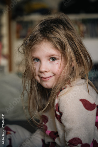A blond little girl with chickenpox