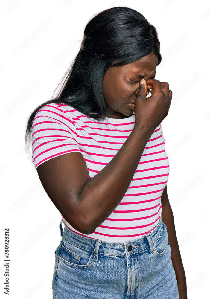 African young woman wearing casual striped t shirt tired rubbing nose and eyes feeling fatigue and headache. stress and frustration concept. African young woman wearing casual striped t shirt tired rubbing nose and eyes feeling fatigue and headache. stress and frustration concept.