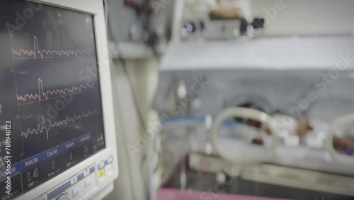 Monitor of Neonatal Intensive care unit, a premature baby in incubator, monitoring the vital signs and ECG of the patient photo