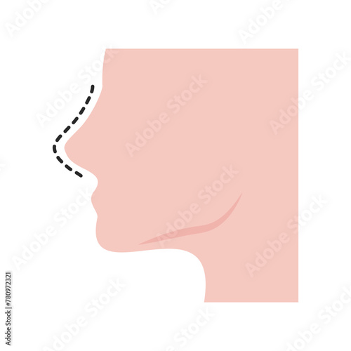 Rhinoplasty. Nose job. Beauty, plastic surgery, medical treatment concepts. Flat vector design illustration isolated on white background. 