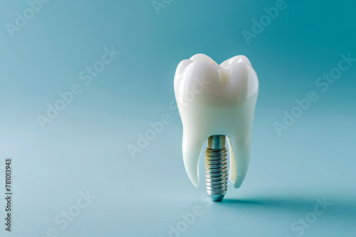 Dental Implant Procedure Implant Supported Teeth. Generative AI