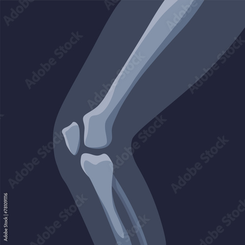 Human bones orthopedic and skeleton icon, bone x-ray image of human joints, anatomy skeleton flat design vector illustration