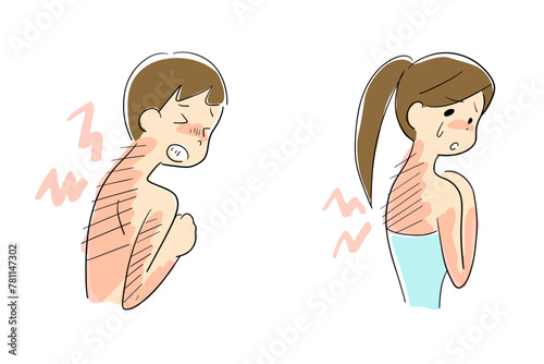 日焼けした背中が痛む男性と女性