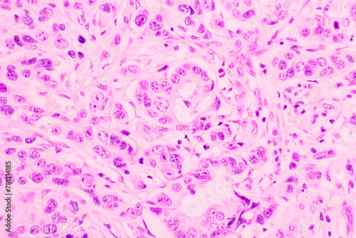 Papier peint Backgrounds of human cells tissue of lung human under the microscope in pathology lab