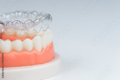 Invisible and removable aligners for teeth alignment