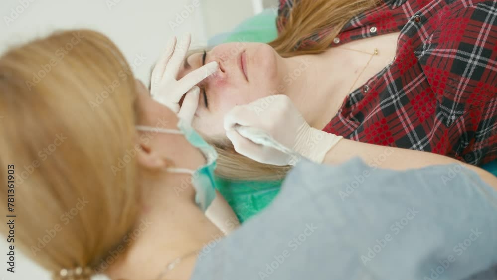 The doctor removes small blood vessels on the client's face with a laser. Cosmetology procedure with observance of sterility. High quality 4k footage The doctor removes small blood vessels on the client's face with a laser. Cosmetology procedure with observance of sterility. High quality 4k footage
