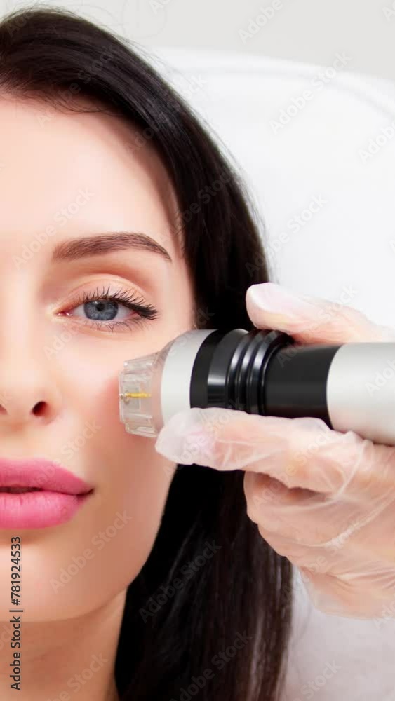 Attractive young woman undergoing a cosmetic procedure in a beauty salon. A woman undergoes fractional RF lifting. Advertising concept for clean and young facial skin. Attractive young woman undergoing a cosmetic procedure in a beauty salon. A woman undergoes fractional RF lifting. Advertising concept for clean and young facial skin.