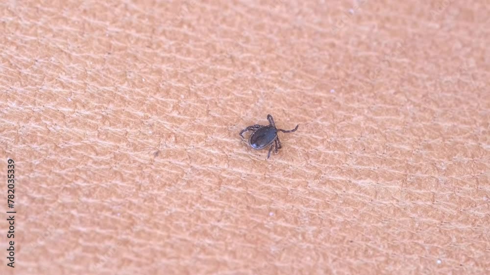 parasitiform tick Ixodidae, blood-sucking parasites crawls on skin, Acariformes, carrier of dangerous disease encephalitis, illness symptoms, tick-borne disease prevention strategies, research studies parasitiform tick Ixodidae, blood-sucking parasites crawls on skin, Acariformes, carrier of dangerous disease encephalitis, illness symptoms, tick-borne disease prevention strategies, research studies