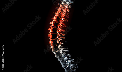 X-ray of human spine with trigger pain point for medical education