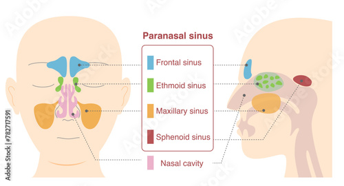Illustrative illustrations of the anatomy of the paranasal sinuses from frontal and lateral sagittal plane views photo